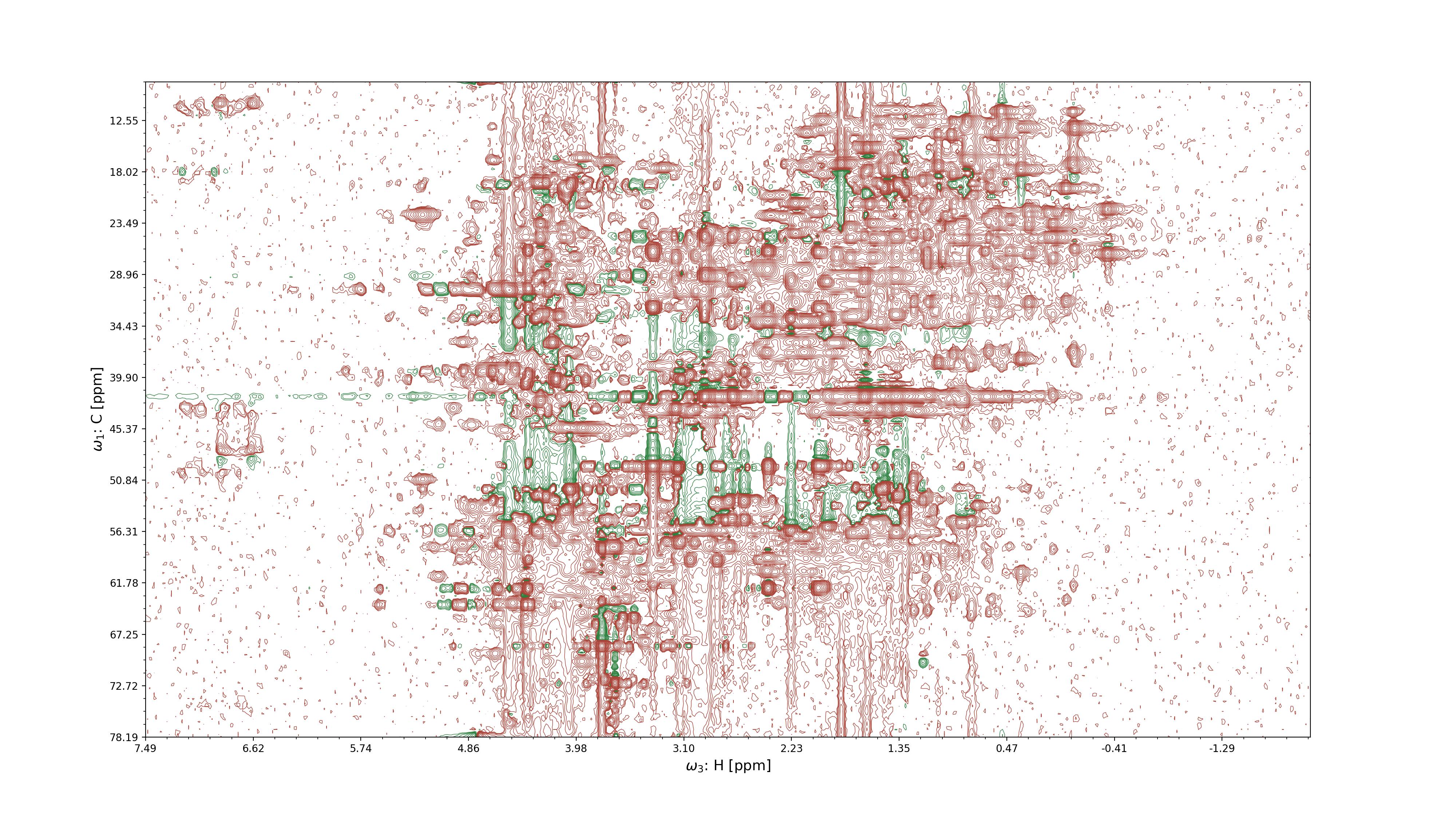 2D projection of an NMR spectrum